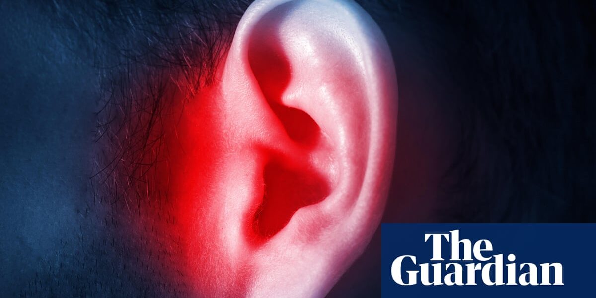 According to researchers, a recent application has the potential to lessen the negative effects of tinnitus.