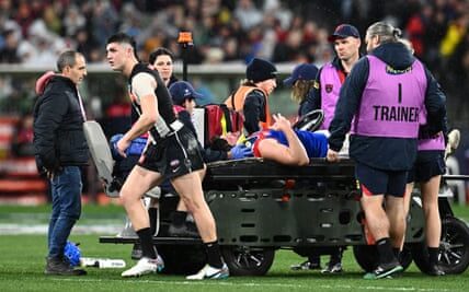 Australian sport has come to terms with and is slowly embracing the potential risks associated with concussions, bringing about a new reality for athletes and organizations. This has been acknowledged by Jack Snape.