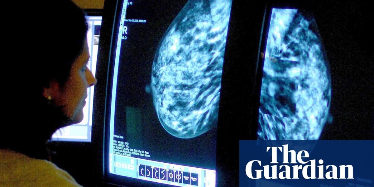 A potential treatment for breast cancer could benefit a significantly higher number of women than originally estimated.