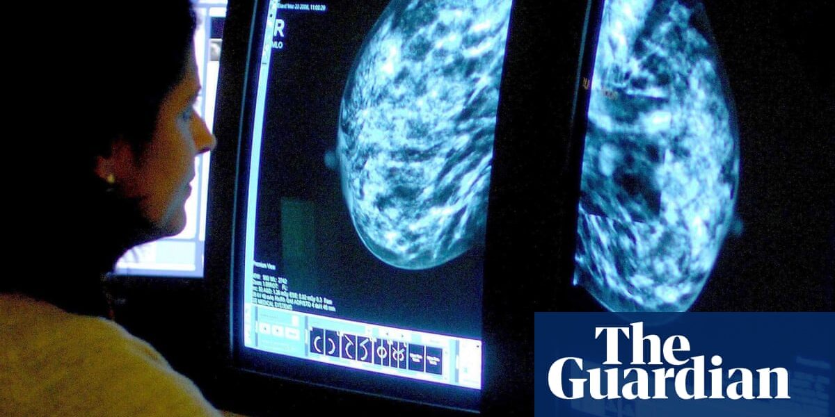 Doctors create AI tool for forecasting adverse reactions in women with breast cancer.