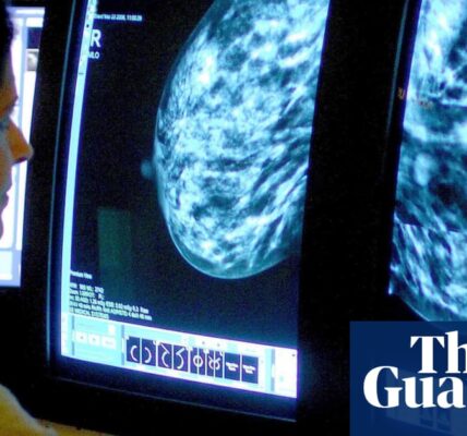 Doctors create AI tool for forecasting adverse reactions in women with breast cancer.
