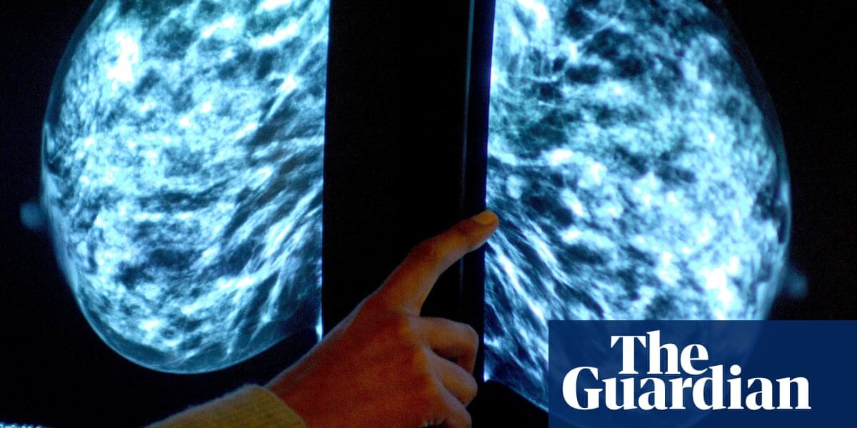 Scientists from the United Kingdom are developing a bra with a built-in monitor to track breast cancer.