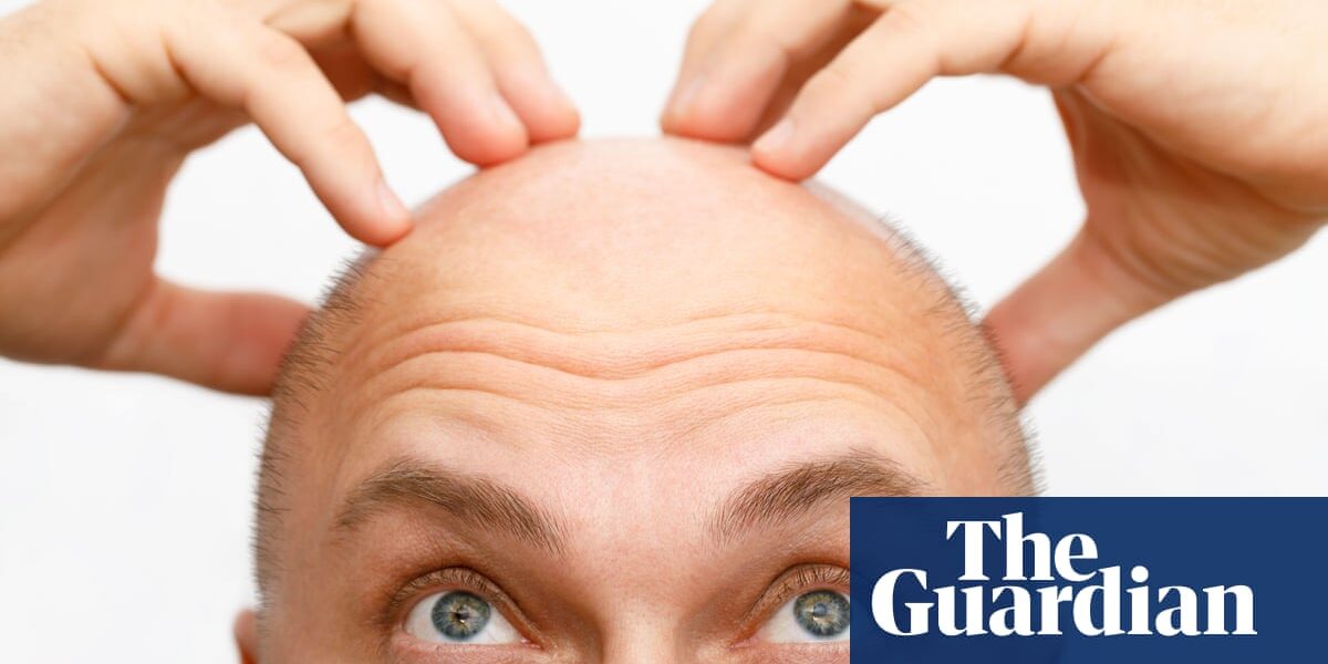 What causes hair loss as we get older, and how can we address it? - podcast