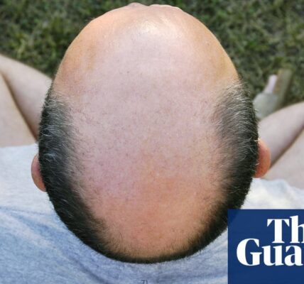 Bald by Stuart Heritage review – hair today, gone tomorrow