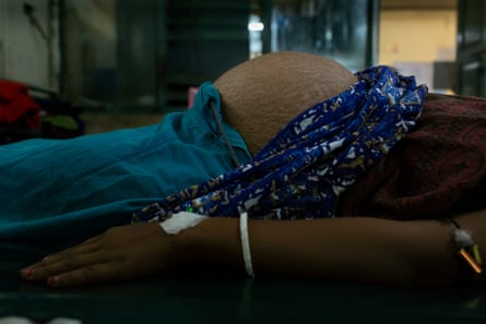 Close up of a heavily pregnant woman lying on a hospital bed with her bump exposed