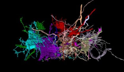 AI brain map could help demystify Alzheimer’s and autism
