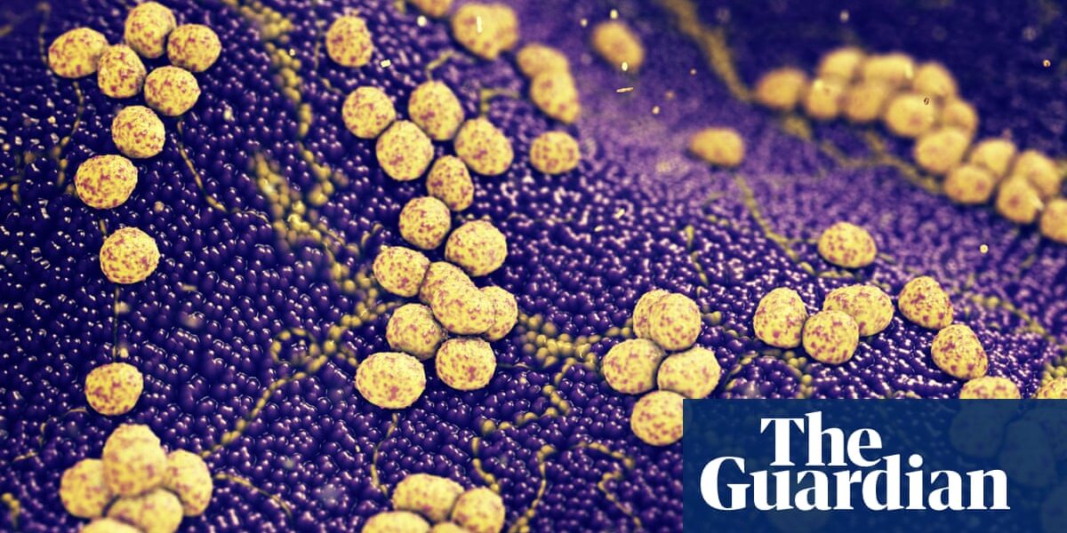 Huge number of deaths linked to superbugs can be avoided, say experts