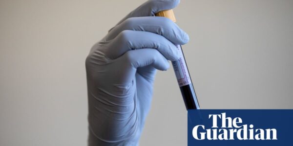 Prostate cancer screening methods trialled in ‘pivotal moment’