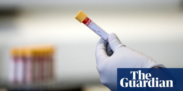 Proteins in blood could provide early cancer warning ‘by more than seven years’