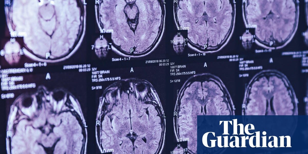 Top Canadian scientist alleges in leaked emails he was barred from studying mystery brain illness