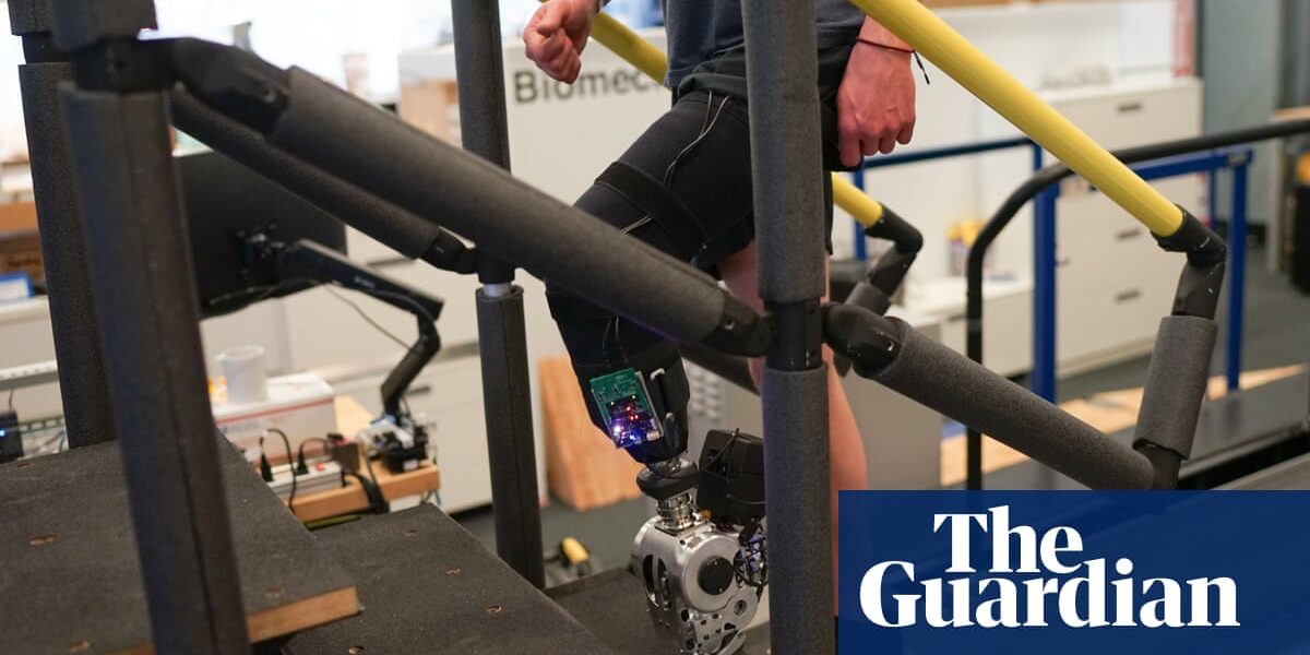 Bionic leg makes walking quicker and easier for amputees, trial shows